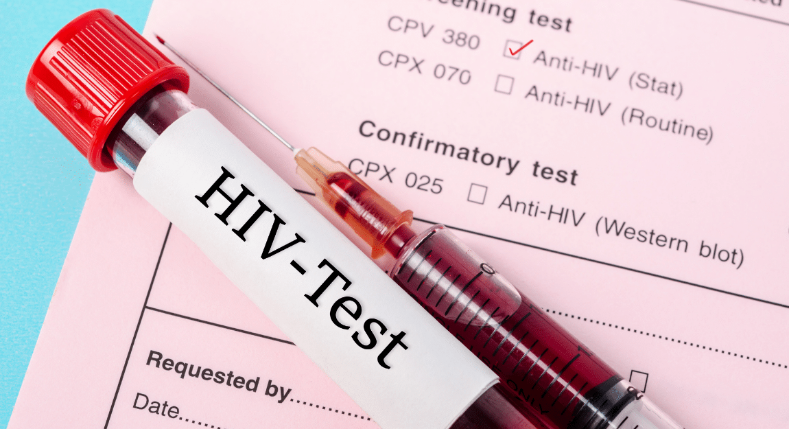 Life Insurance for HIV Positive Applicants